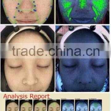 Digital 3d Scanner Facial Microscope Skin Analyzer Check Acne Wrinkles Moisture Scanner photo-3