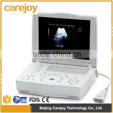 Hospital clinical equipment 15-inch full digital Laptop Ultrasound Scanner China made portable ultrasound machine