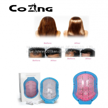 Portable Bald Laser Head Hair Growth Cold Laser Treatment Helmet for Home Remedy photo-2