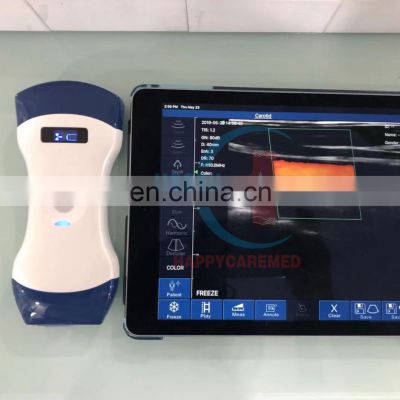 HC-A009E Hot sale Dual-purpose wireless probe (linear and convex) portable linear  probe and convex probe