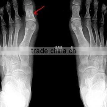 Medical X-ray Film /fuji Printing Clear Image Medical Dry Film With Factory Price photo-2