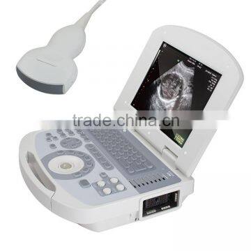 Medical Devices Digital Clear Imaging Portable Ultrasound Machine for Pregnancy photo-2