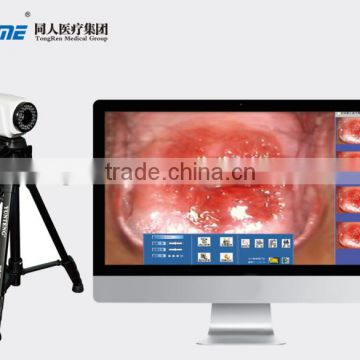 Digital Video Colposcope, Laptop Video Colposcope, Gynecology Video Colposcope