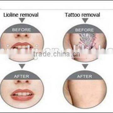 Painless Stationary Beauty Equipment Salon And Home Use 8 White In 1 With Multi Function Acne Removal Swing Arm photo-6