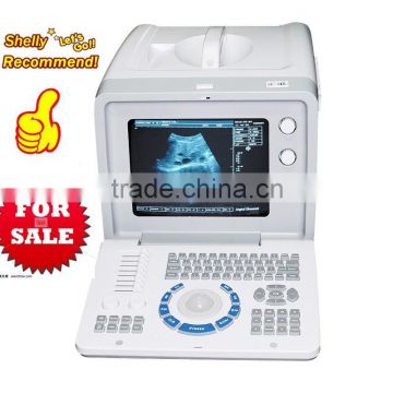 On Sale CE Portable Hospital ClinicUltrasound Medical Diagnose Scanner/Machine With Probes Transducer-Shelly