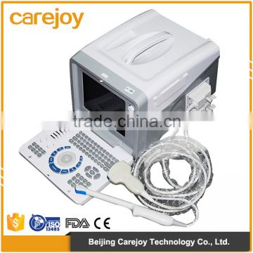 China Hot Sale Cheap Price 10-inch high resolution monitor Convex Ultrasound Scanner for pregnancy