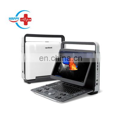 Hot Sale Sonoscape E3 Portable 15 Inch LCD Laptop Ultrasound Device Color Doppler Ultrasound Machine