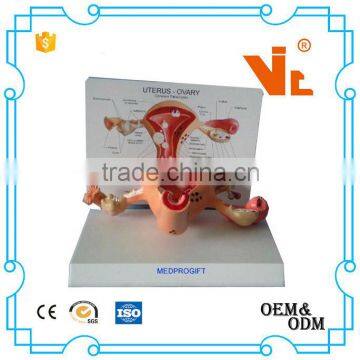 V-AM023 Anatomical uterus ovary care model