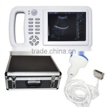 Compact Handheld Ultrasoud Scanner RUS-8000A 3.5MHz convex array probe Made-in-China