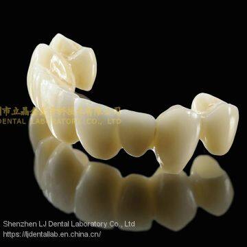 Dental Crown 3M Lava Zirconia, Dental Teeth, Dental Prosthesis, Laboratoire Dentaire, Dentallabor, Laboratorio Dental, Dental Laboratory, Shenzhen LJ Dental Lab China photo-4