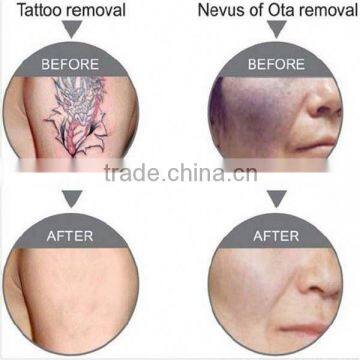 Best China Hot Sale!! Super Fast Color Touch Screen Q-switched nd Yag Laser Age Spot Removal 10HZ photo-6