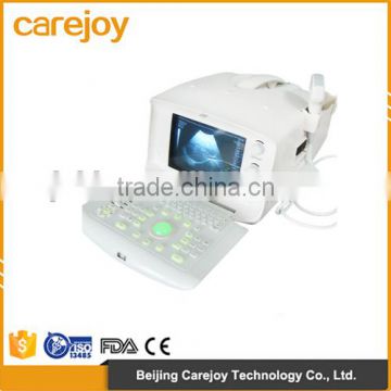 Factory price!!CE approved 3.5Mhz multi-frequency convex probe Portable B-Mode Ultrasound Scanner system