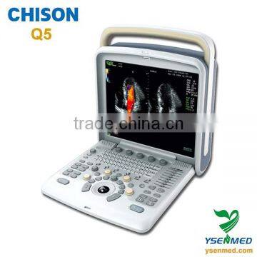 medical 4d portable color ultrasound Chison q5 ultrasound