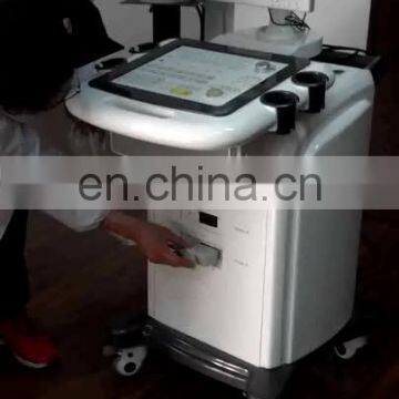 MY-A019 Medical Ultrasound Transducer Standard Ultrasound Scanner with Trolley