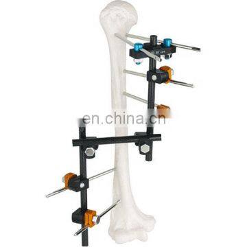 Orthopedic Surgical Instruments Femur&Tibial External Fixator for Femur&Tibia Surgery photo-3