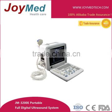 portable 12inch full digital ultrasound diagnostic machine/ultrasonography