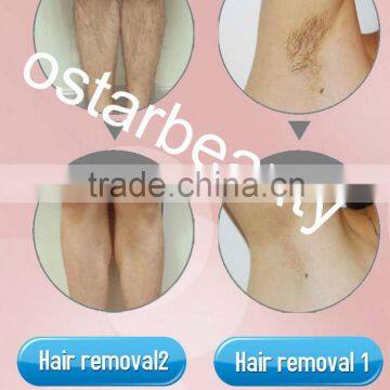 Portable Salon Equipment 808 Laser Hair Removal Beauty Machine DH 04 photo-6