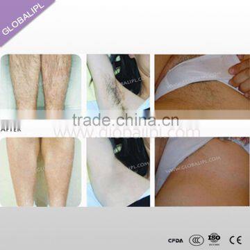 World-class Leg Beard Lip All Kinds of Hair Remvoal Aesthetic Machine photo-6