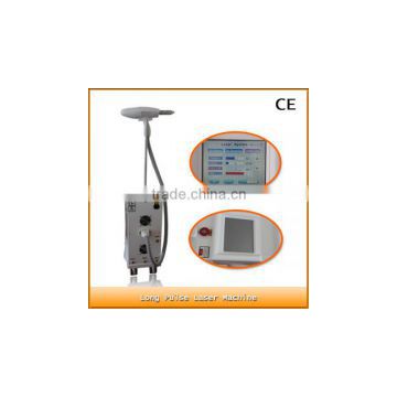 Hot sale Medical nd yag laser machine for hair removal/Spider pattern hair loss