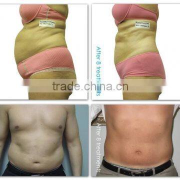 The Most Popular and Professional Lipo Laser Fat Burning Beauty Equipment for Home Use and Clinic With CE Approved