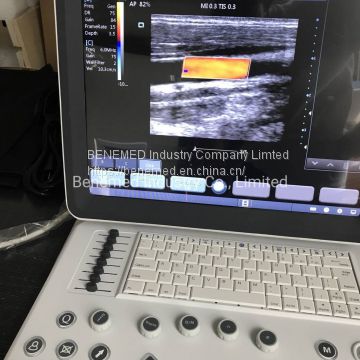 High Quality Ultraslim Notebook Type Black and White Ultrasound Scanner