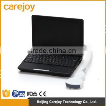 CE*ISO approved Laptop Ultrasound Machine with 3.5Mhz Convex probe with battery