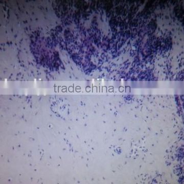 Salivary gland pleomorphic adenomas oral histology pathology parasitology prepared slides