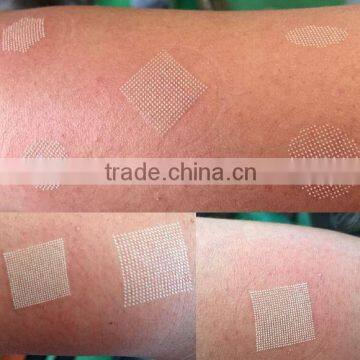 Acne Scar Removal Sanhe Fractional Laser Co2 US RF Tube Skin Tightening System/ Oxygen Machine For Skin Care Portable