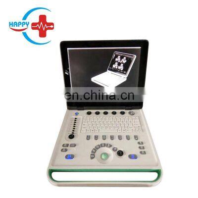 HC-A006B Full Digital 15 Inch Laptop Ultrasound Machine With Competitive Price(ARM Based) photo-2
