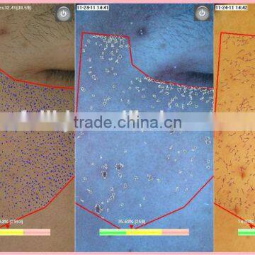 Factory Promotion Facial Skin Moisture Tester Beauty Peronal Care Machine photo-6