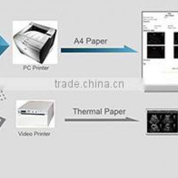 Medical User-friendly 2d Portable Black and White Ultrasound CHISON ECO2 photo-5