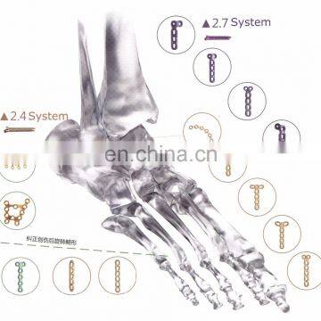 Mini Locking Implant Plate System photo-3
