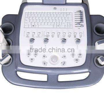 Echo Color Doppler 3D Function Laptop/Notebook Ultrasound photo-6