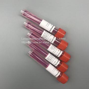 Disposable viral transport tube sterile swab kit virus sampling tube VTM&UTM Kit