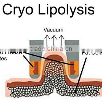 Criolipolise OEM Factory Supplier Aparelho Criolipolise photo-4