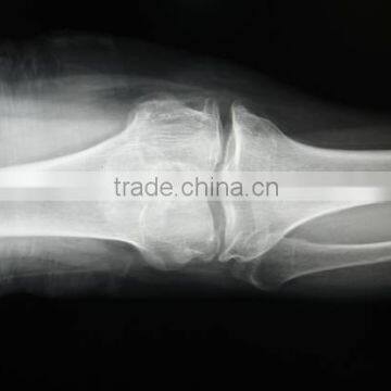 CE KND-A/F Medical Thermal x Ray Film China photo-6