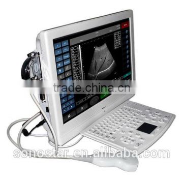 UTouch-8 Touch Screen LCD Ultrasound Scanner(ultrasoni,black white,scan