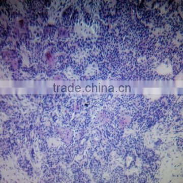 Oral cavity Diseases Pathology Slides