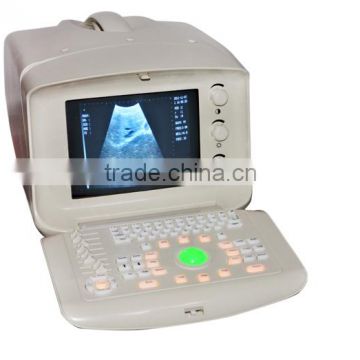 Digital Portable Ultrasound Scanner