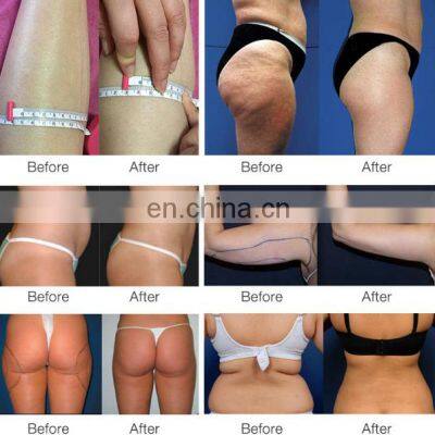 New Arrival 6 in 1 Vacuum RF 40k Ultrasonic Cavitation Slimming Machine With 8 Pads Lipo Laser photo-4