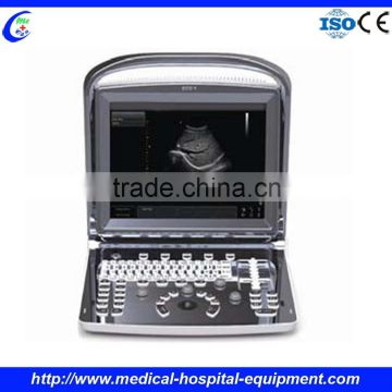 Price Medical Ultrasound Portable