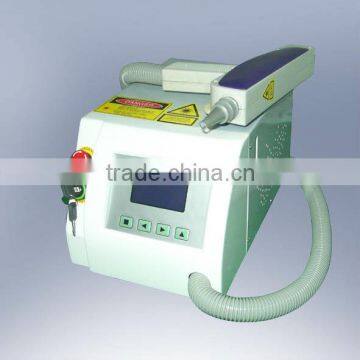 laser tattoo removal equipment