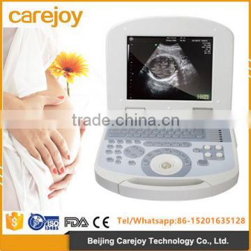 2017 new Digital Portable Ultrasound Scanner Suitable for the diagnosis of Abdomen, Cardiac, Gynecology, Obstetrics