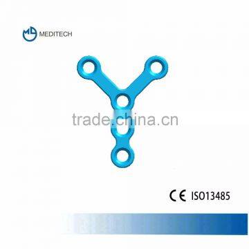 1.5mm Y-shaped maxillofacial orthopedic titanium plates