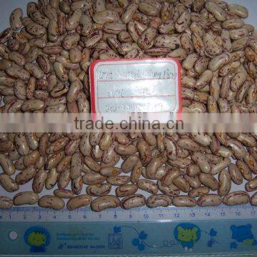 Light Speckled Kidney Bean