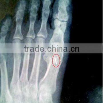 medical x ray film, medical x ray film of printing consumables