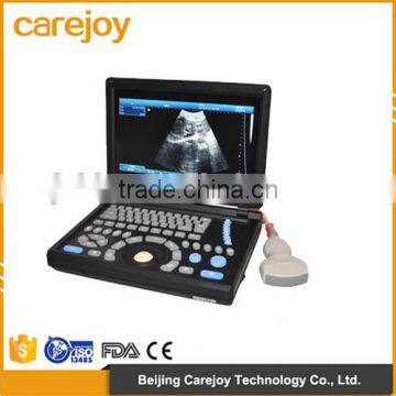 CE approved Notebook Ultrasound Scanner with 3.5Mhz multi-frequency convex probe RUS-9000E2