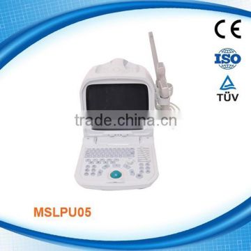 portable ultrasound machine for pregnancy with ultrasound scanner MSLPU05W