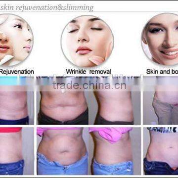 2015 New Multifunction rf Laser Slimming Machine photo-6