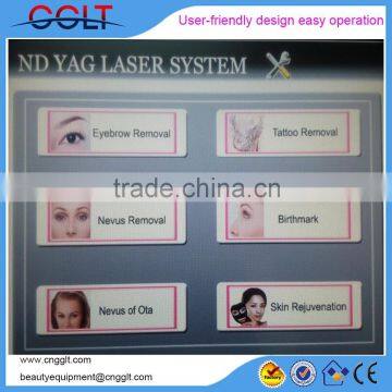 Laser Tattoo Removal Victory photo-2